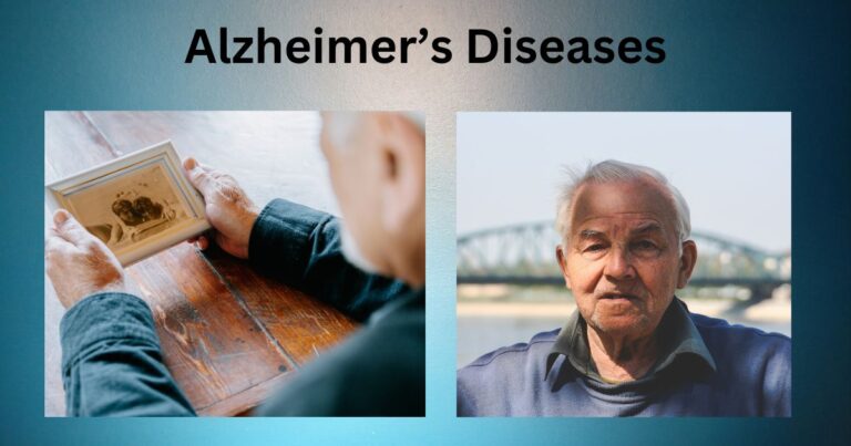 Alzheimer's Diseases