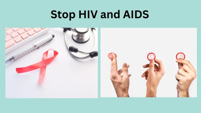 HIV and AIDS